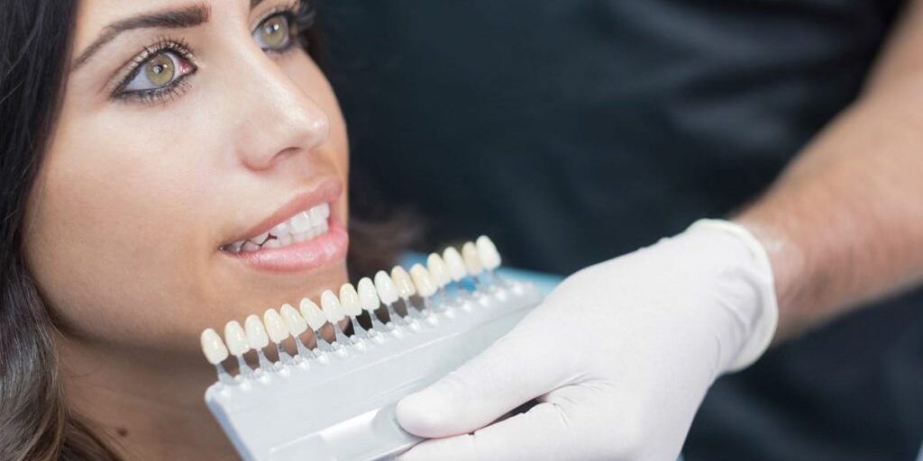 carillas-dentales-porcelana-clinica-dental-estudio