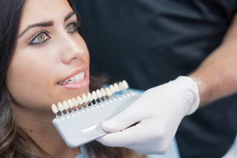 carillas-dentales-porcelana-clinica-dental-estudio carillas-dentales-porcelana-clinica-dental-estudio