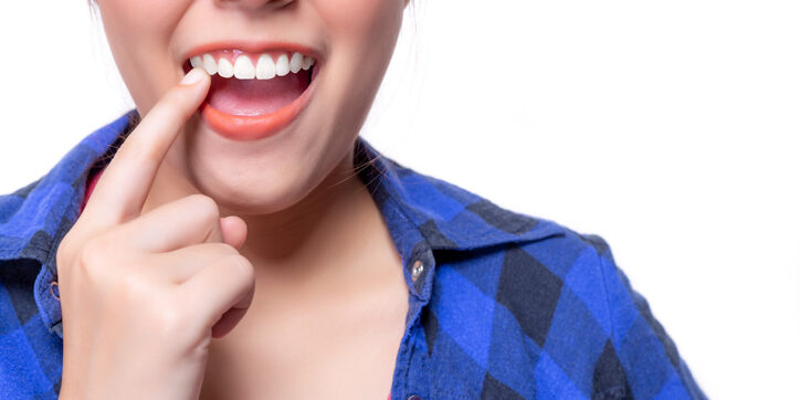 ¿Cuándo es necesario un injerto de encía?